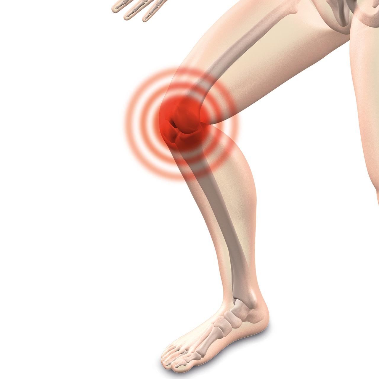 The 3d Technology That Could Revolutionize The Treatment Of Osteoarthritis Of The Knee